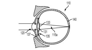 Smartphone Eye Implant
